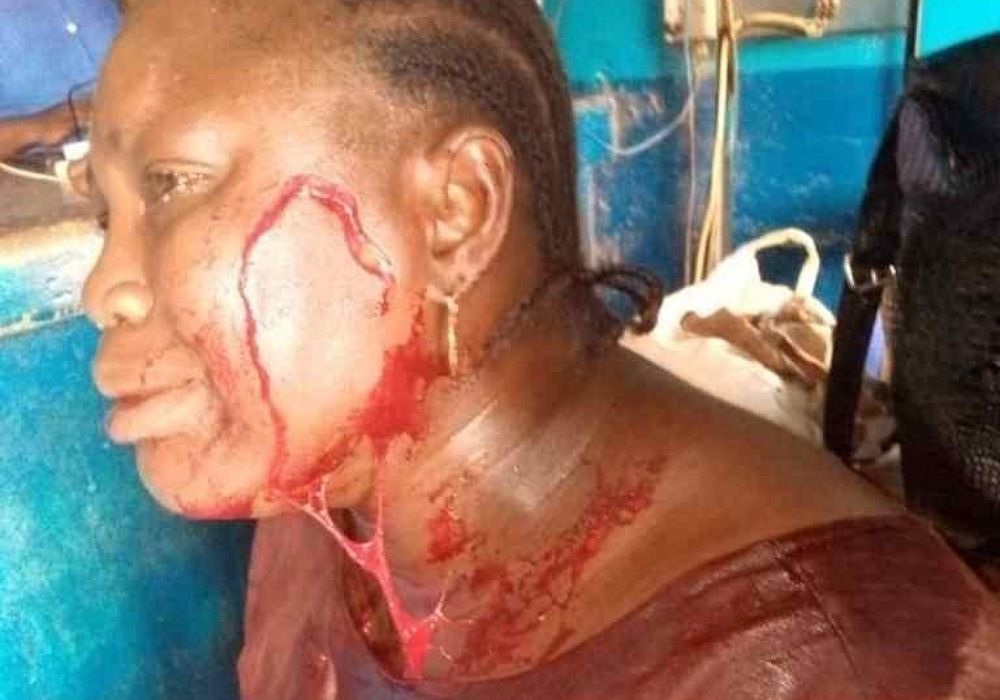 APC woman leader stabbed in Osun