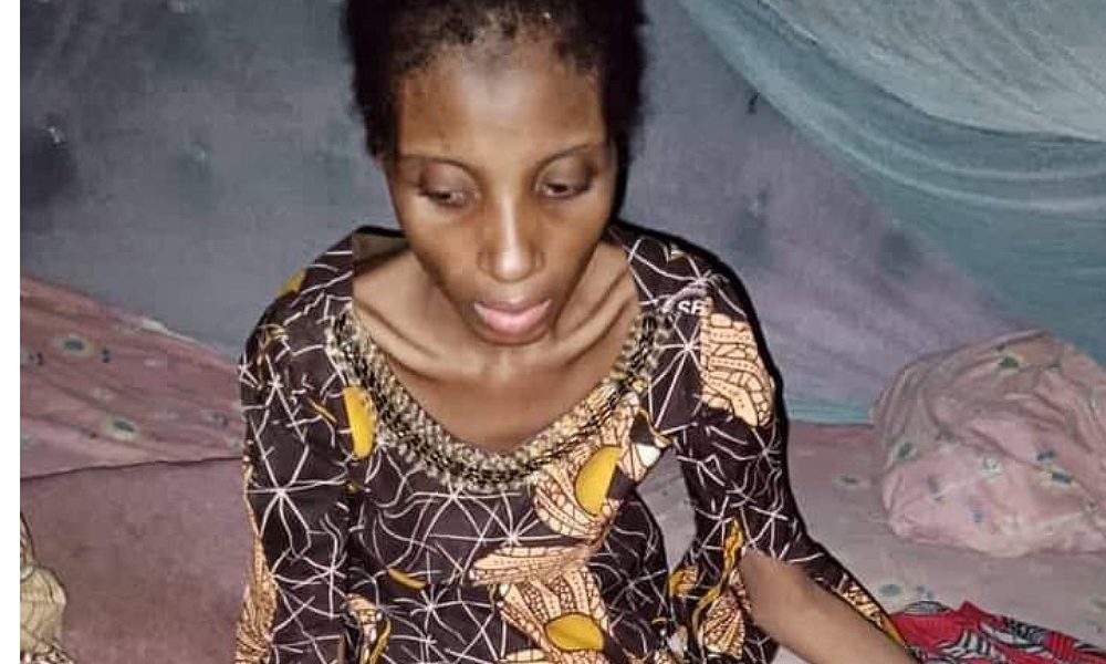 Woman Detained, Starved For One Year In Yobe By Husband Is Dead