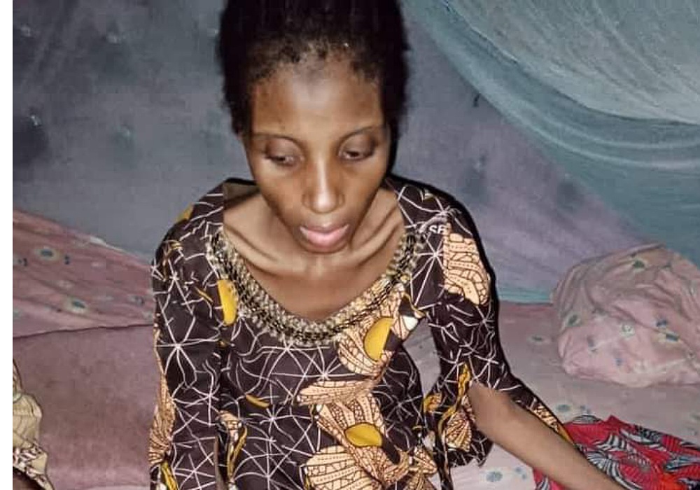 Woman Detained, Starved For One Year In Yobe By Husband Is Dead