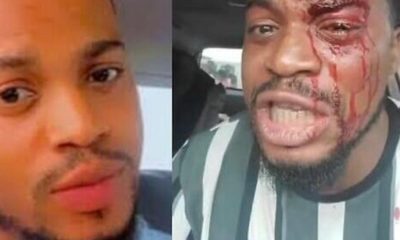 Area Boys Brutally Harassed Actor Akeem Adeyemi While Filming In Lagos