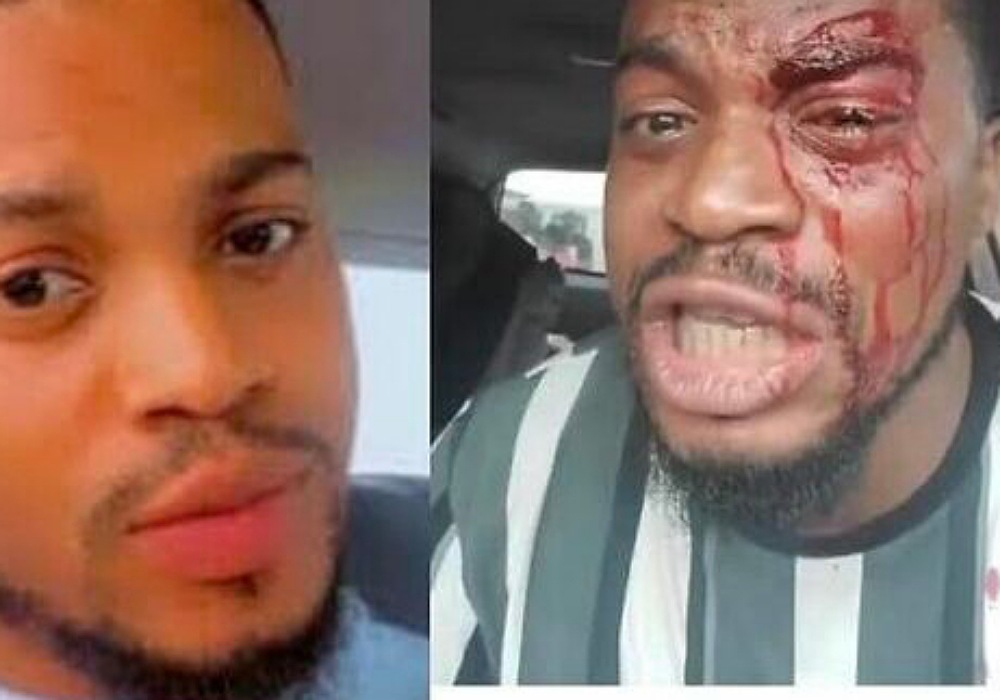 Area Boys Brutally Harassed Actor Akeem Adeyemi While Filming In Lagos