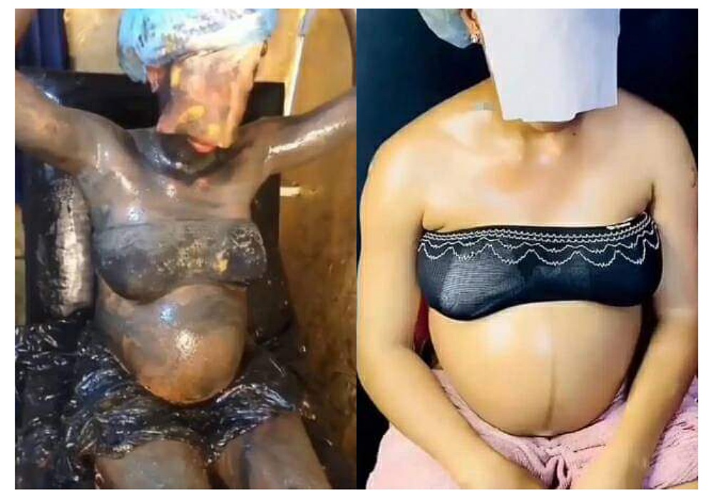 Reactions As Heavily Pregnant Woman Undergoes Chemical Bleaching tagged ‘Lightning Glow Bath’