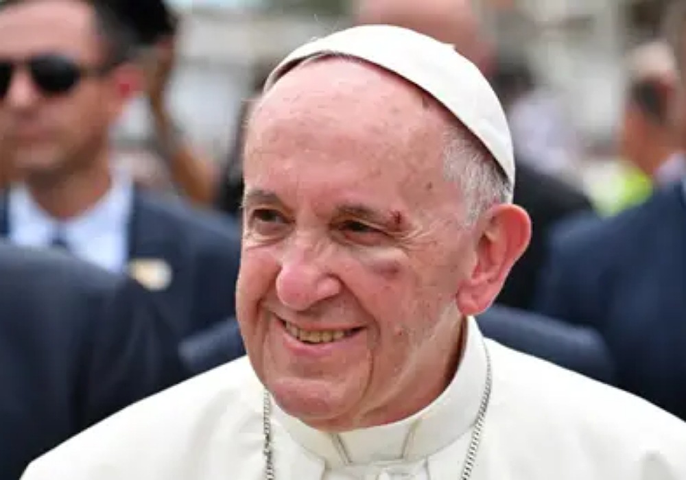 Pope Francis To Undergo Emergency Hernia Surgery